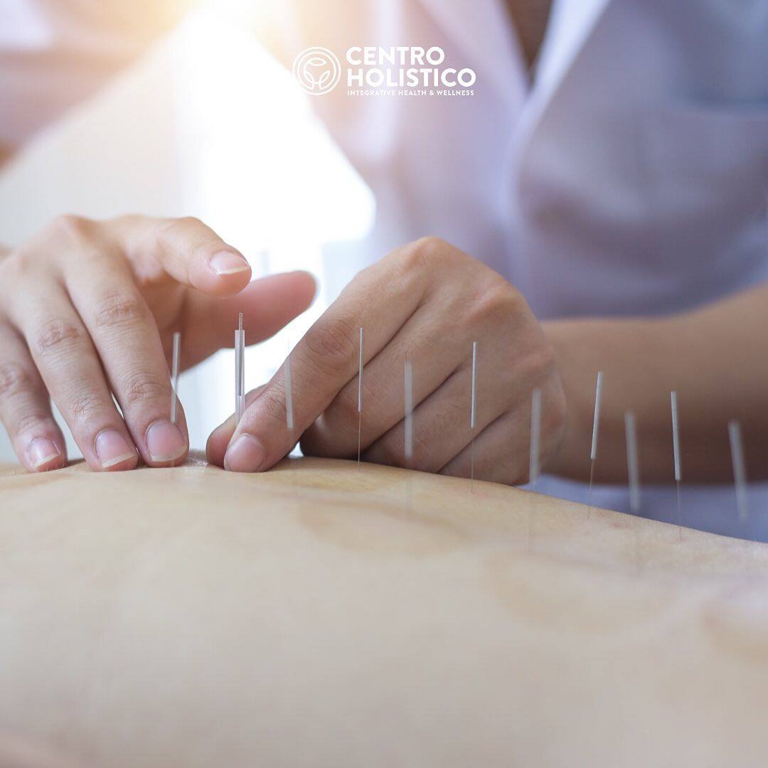 Acupuncture by Centro Holistico Acupuncture by Centro Holistico