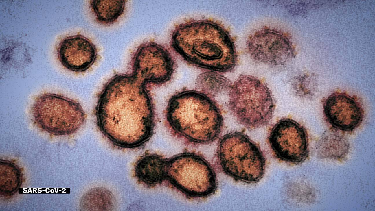 Coronavirus, Explained Coronavirus, Explained